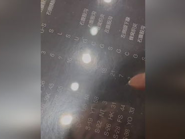 3岁孩子被鼠疫折磨21天